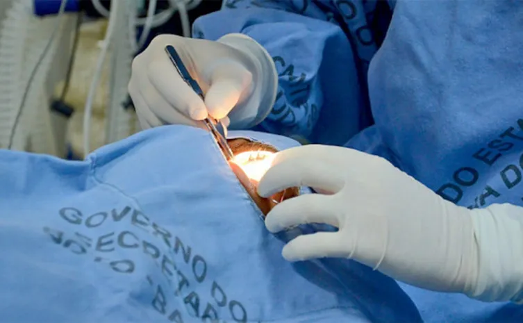 Governo do Tocantins comemora mais de 400 transplantes de córneas no estado